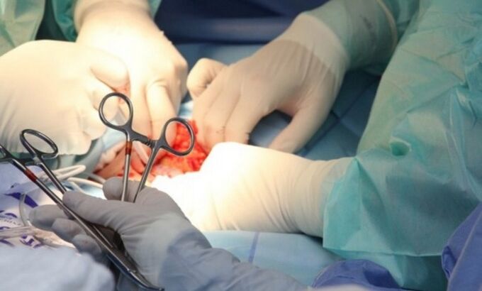 Ligamentotomie – intervenție chirurgicală pentru mărirea penisului