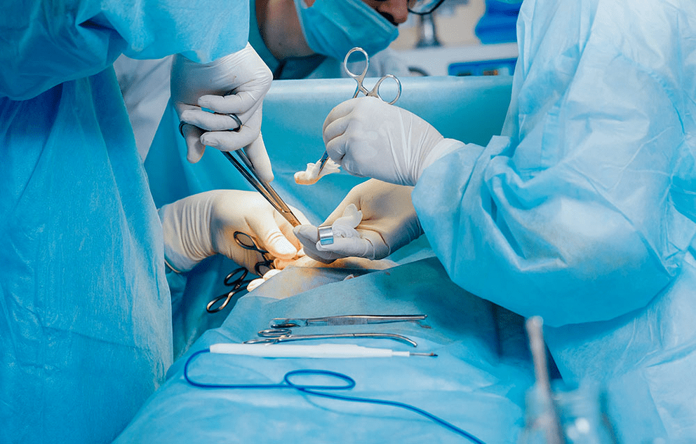 metoda chirurgicala de marire a penisului